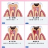 珠海杜牙根和補牙有咩分別？珠海牙科醫院介紹