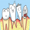 牙周病是否仲能夠治療好？珠海治療牙周病邊度好？
