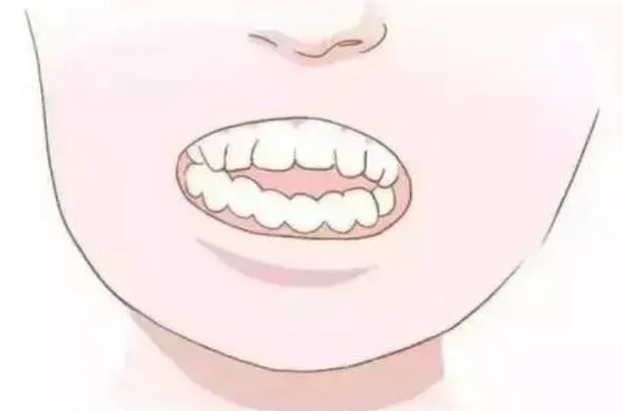珠海箍牙