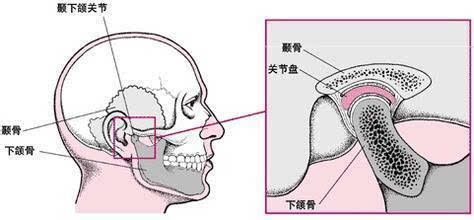 珠海箍牙