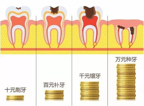 珠海杜牙根價錢