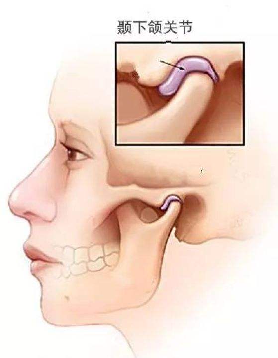 颞下颌关节