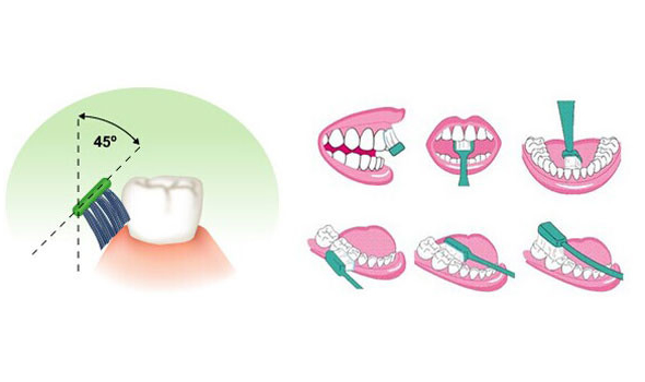 刷牙方式