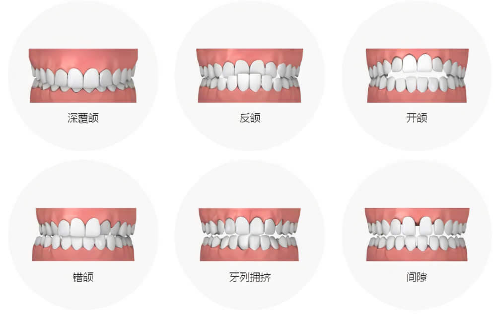 珠海箍牙