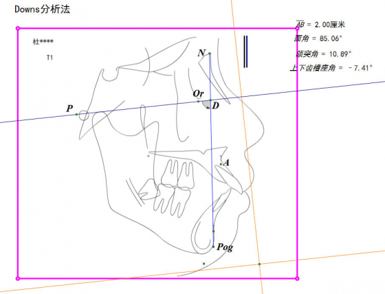 珠海箍牙