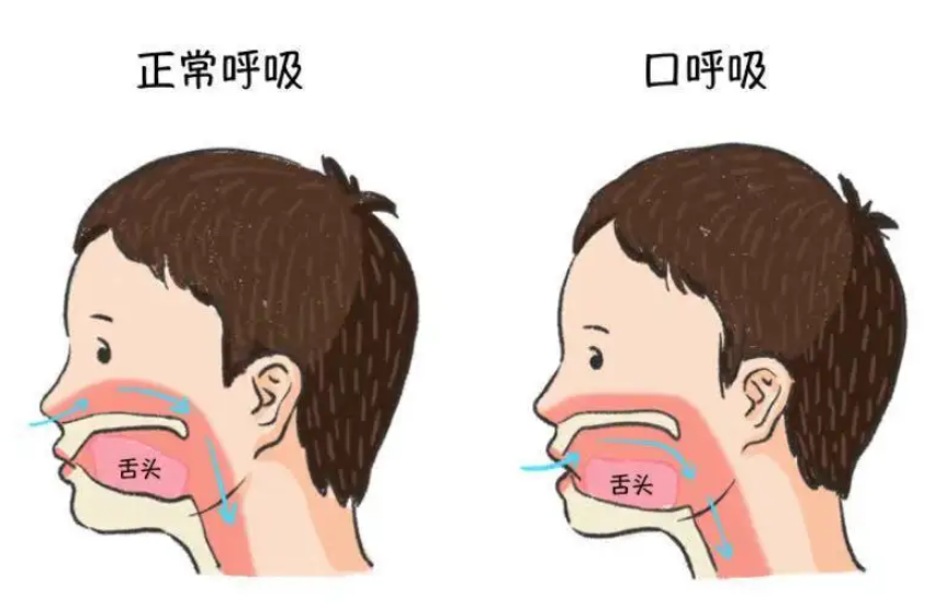 珠海箍牙