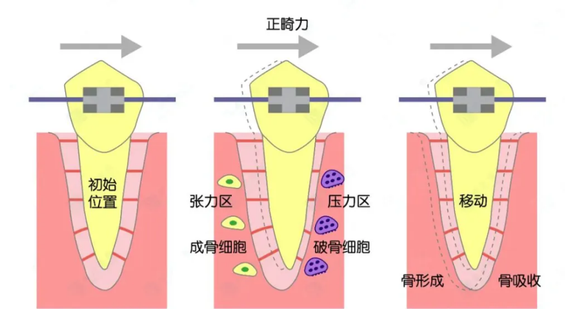 珠海箍牙