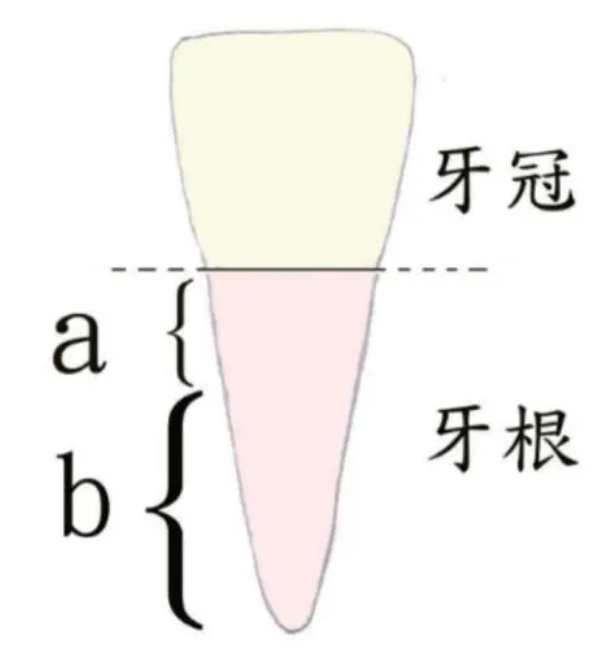 珠海箍牙