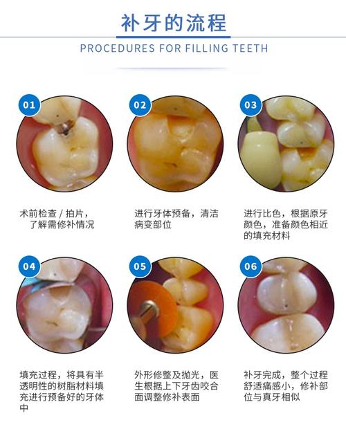 珠海補牙