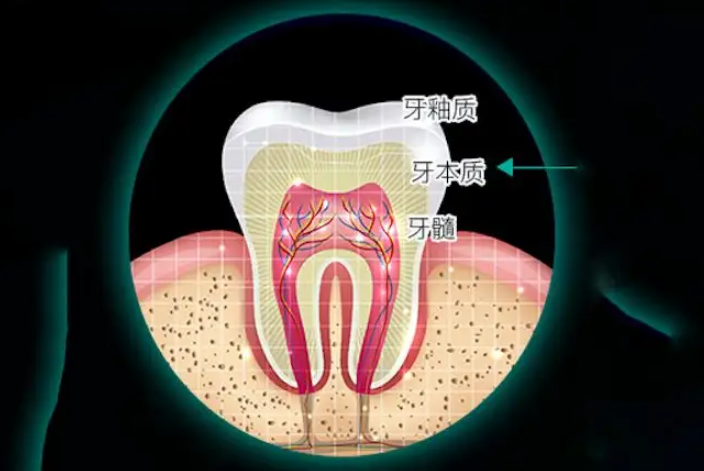 澳門補牙