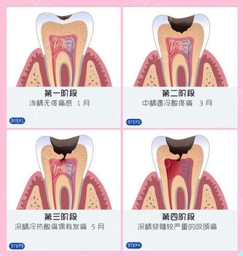 珠海杜牙根