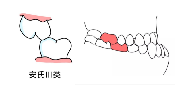 澳門箍牙