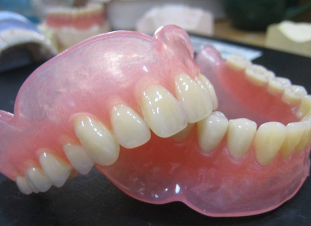 做活動假牙好啲定係種植牙好啲？珠海有無牙科推薦？